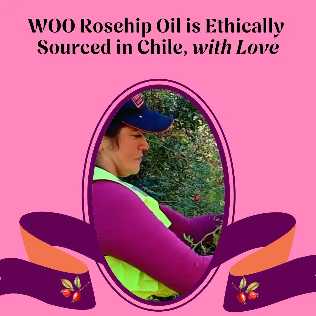 WOO World of Oils - WOO™ Rosehip Oil