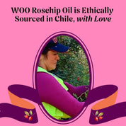 WOO World of Oils - WOO™ Rosehip Oil