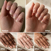 Zizia Botanicals - Forest Nail & Cuticle Oil | Hinoki, Cypress